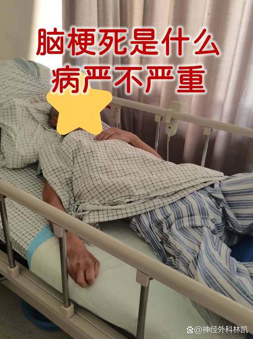 脑梗脑干梗多久能恢复