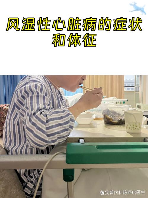 风湿性心脏病晩期症状