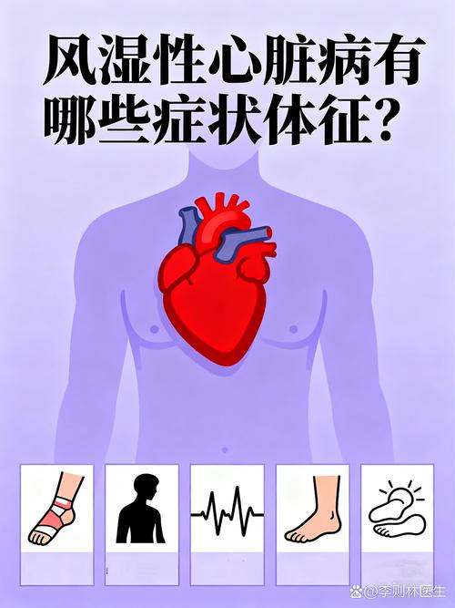 风湿性心脏病晩期症状