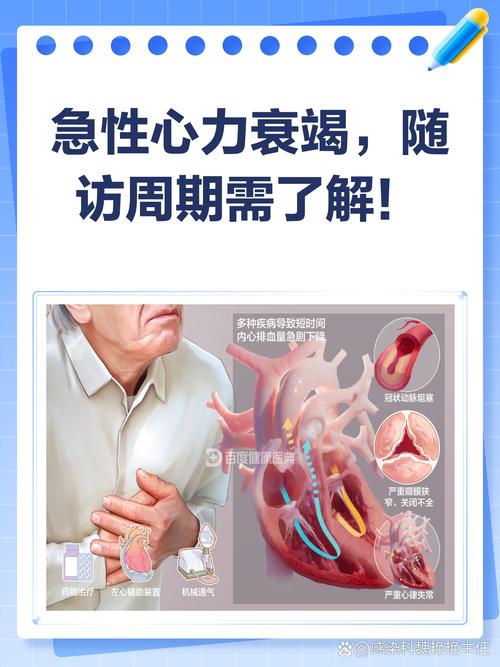 心肺功能衰竭心梗脑梗