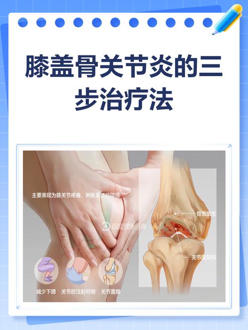 风湿膝关节炎能治好吗
