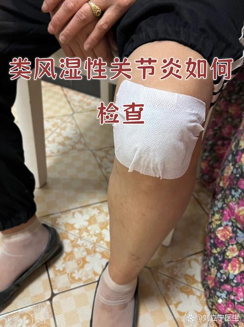 风湿性关节炎怎样检查