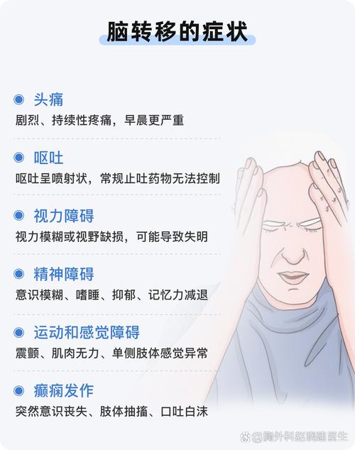 脑梗误诊为肺癌脑转移