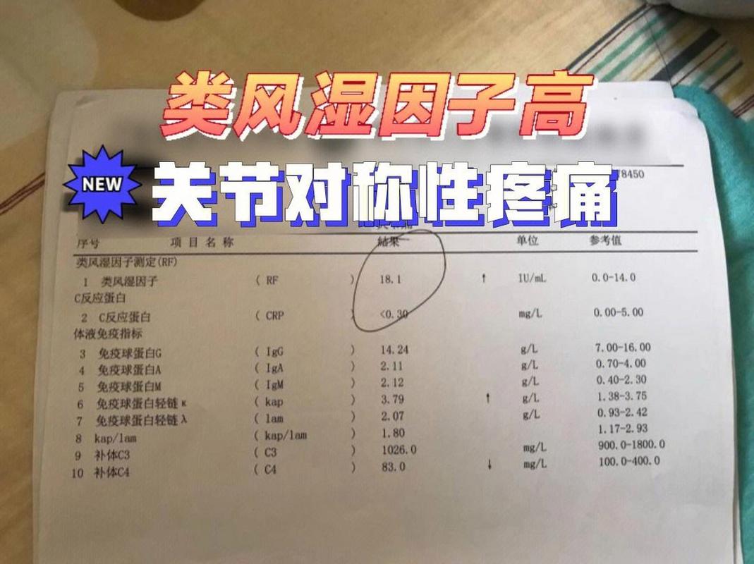 做风湿五项检查多少钱