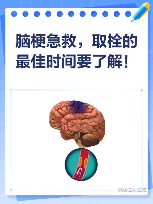心梗之后 脑梗 溶栓