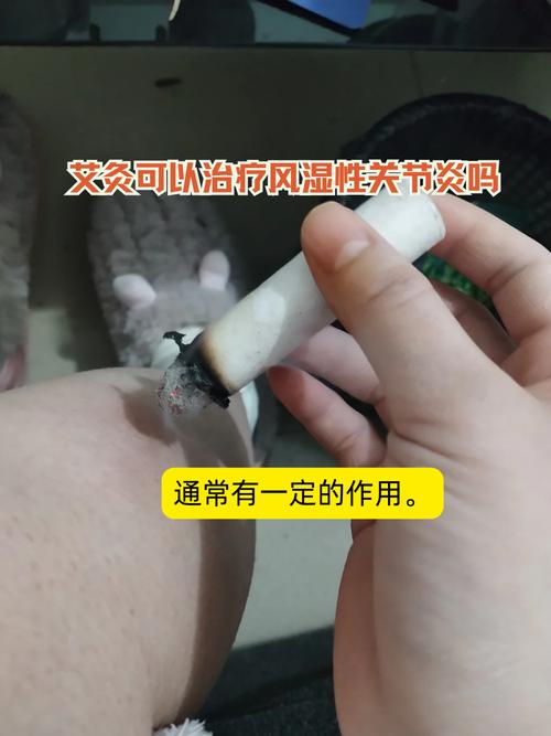 风湿性关节炎怎样艾灸