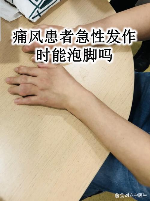 风湿痛一般痛多久才好