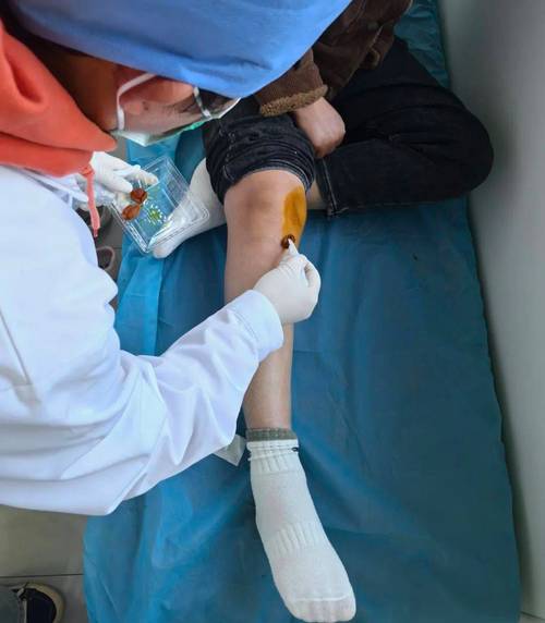 风湿性关节炎治疗视频