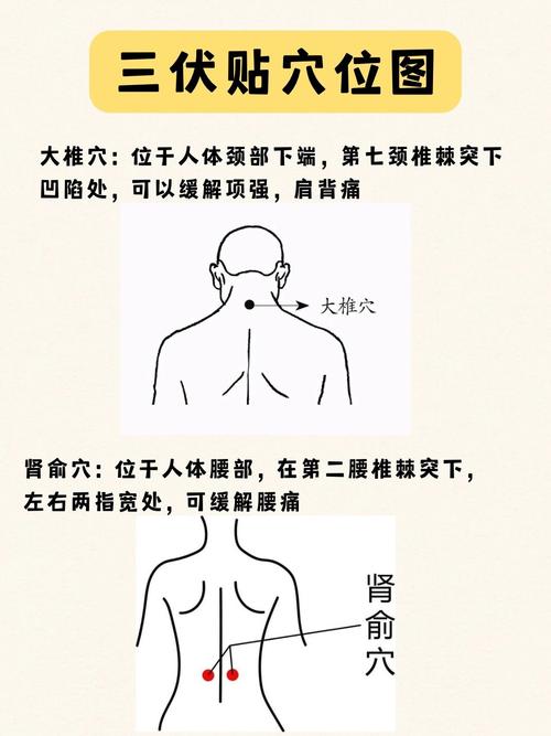 三伏贴风湿贴什么位置