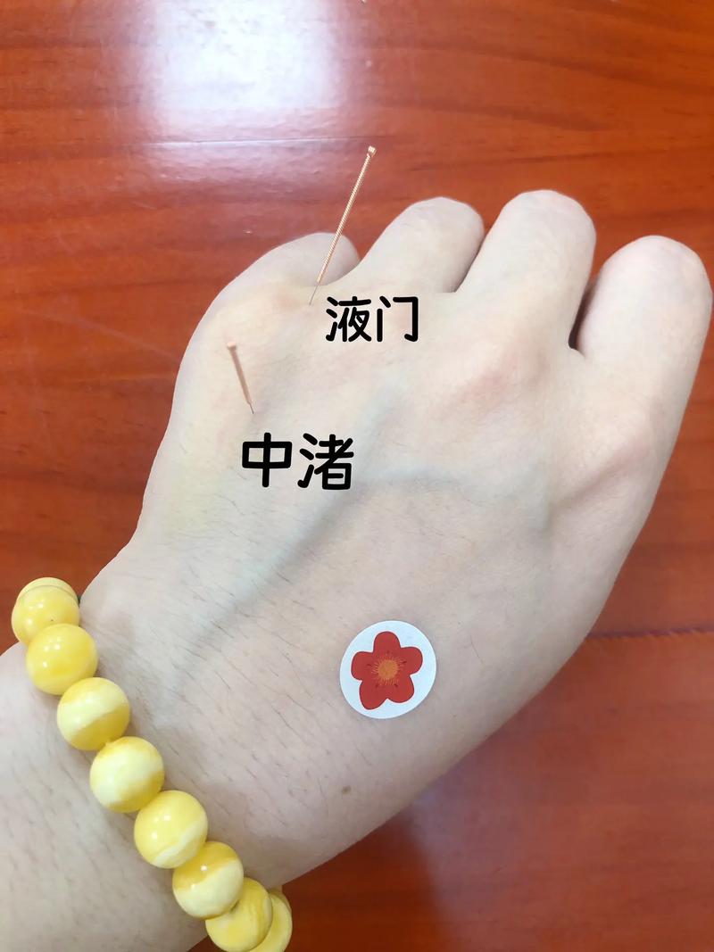 降尿酸针灸什么穴位