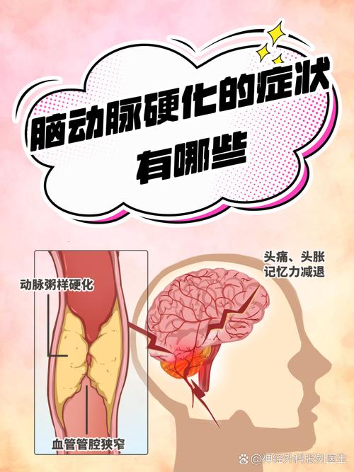 脑动脉纤细会引发脑梗