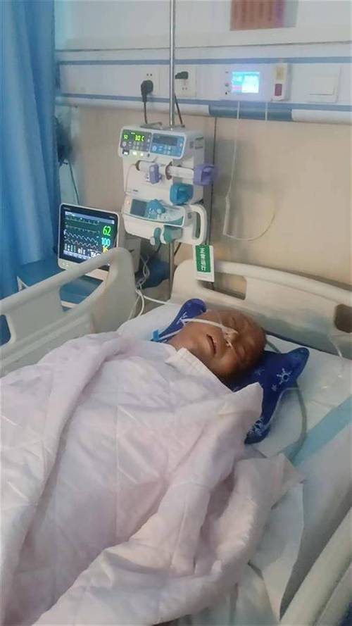 心梗引发脑梗深度昏迷