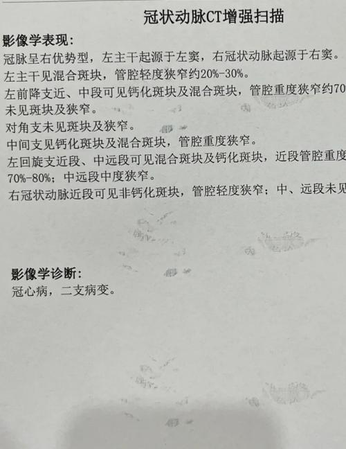 心梗脑梗发光检查项目