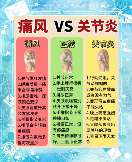 类风湿关节炎怎么回事