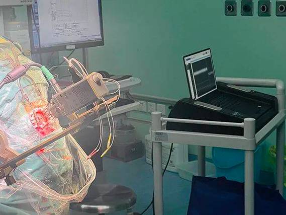 介入治疗脑梗形成脑疝