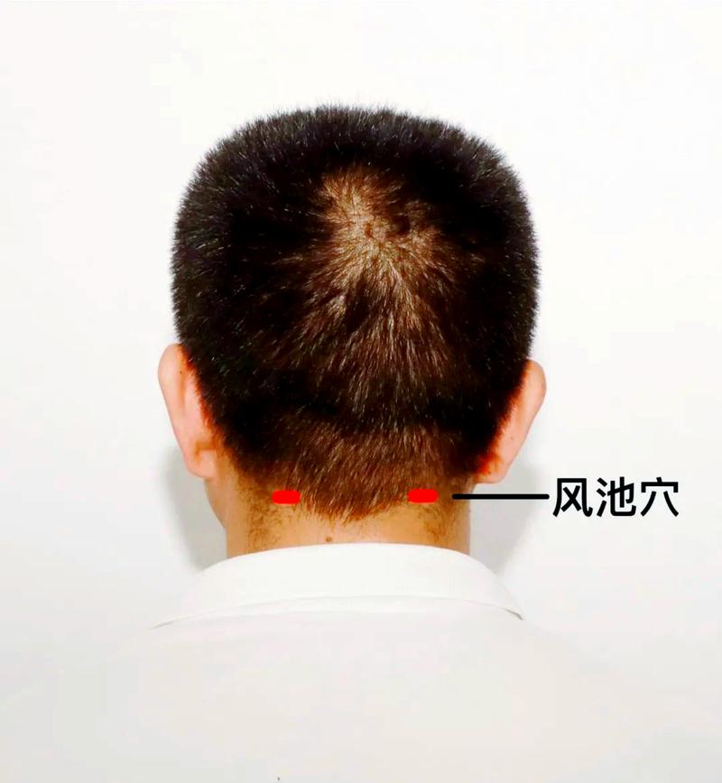 风池穴附近穴位不通