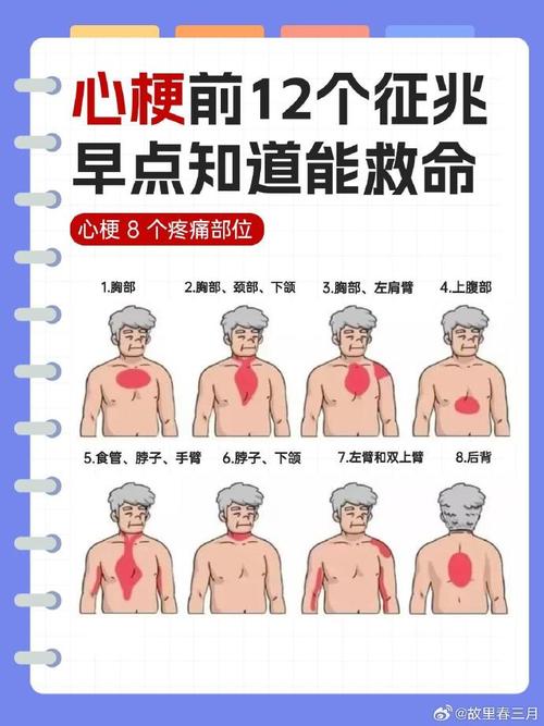 心梗 脑梗有什么症状