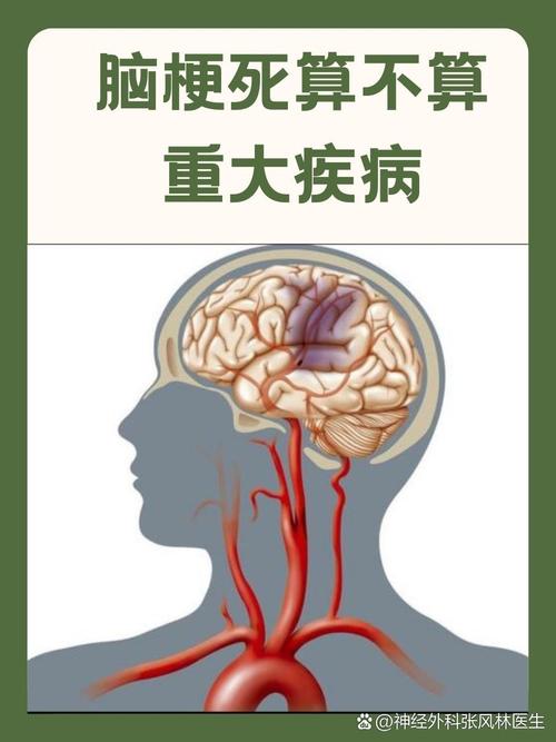 脑梗算不算重大疾病脑
