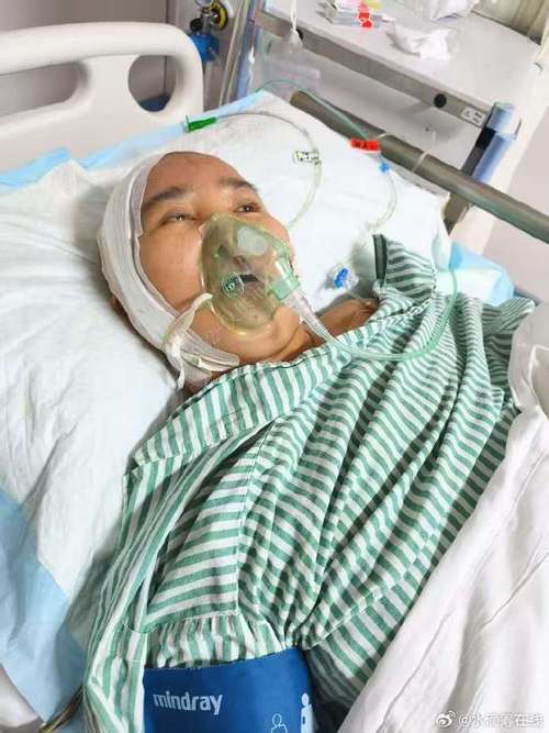 脑梗昏迷脑压高ICU