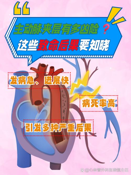 心脏夹层引发心梗脑梗