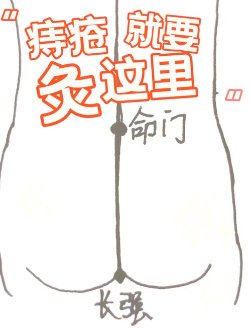 治疗混合痔疮的穴位