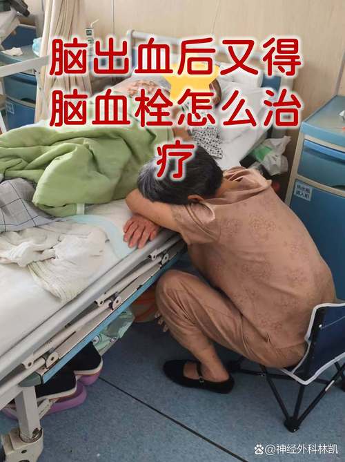 长春前卫医院脑血脑梗