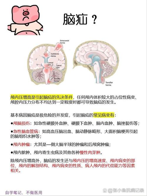 脑疝厉害还是脑梗厉害