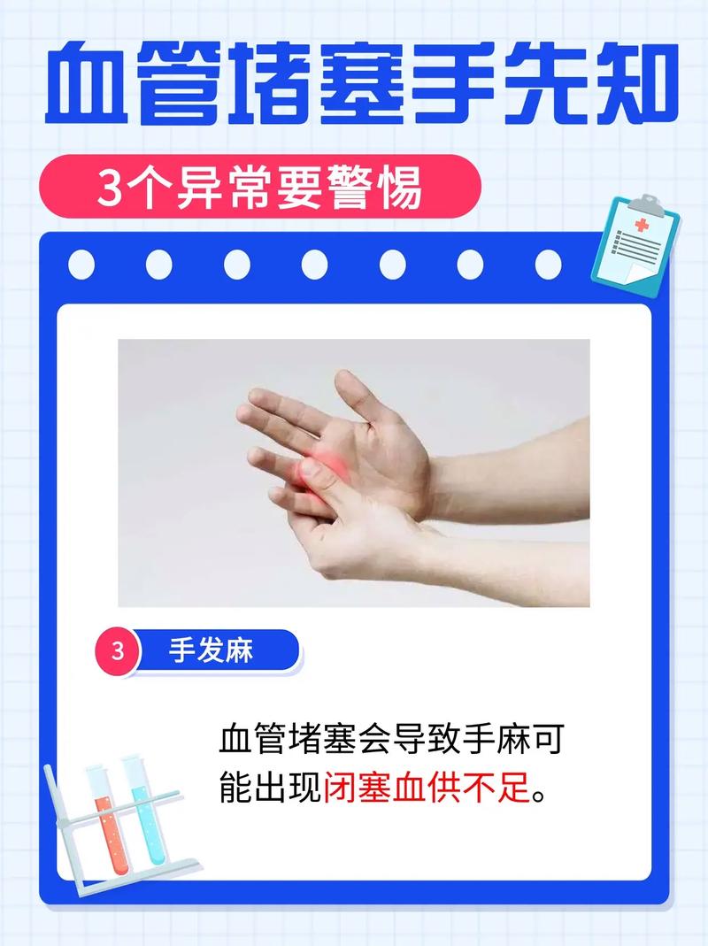 脑梗心梗如何疏通血栓