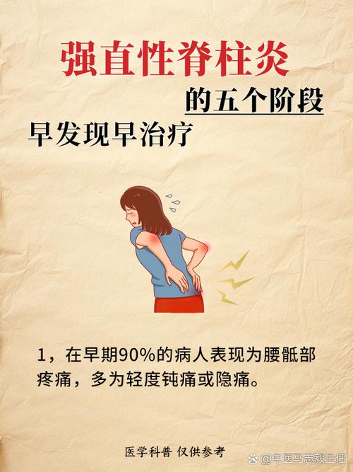 强制性脊柱炎算风湿吗