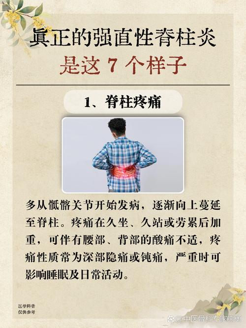 强制性脊柱炎算风湿吗