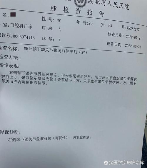 颞颌关节类风湿关节炎