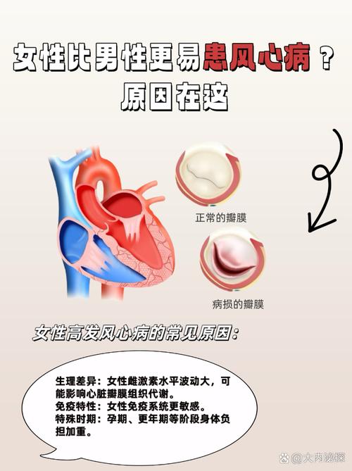 风湿性心脏病严不严重