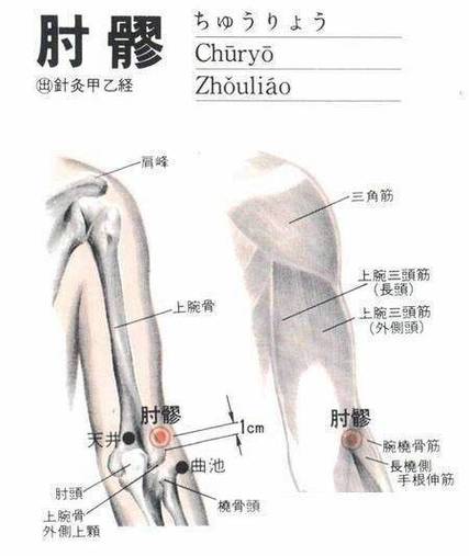 右臂肌肉痛穴位治疗