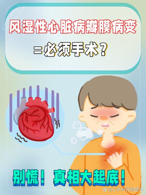 风湿性心脏病是否可治