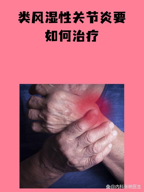 类风湿性关节能治好吗