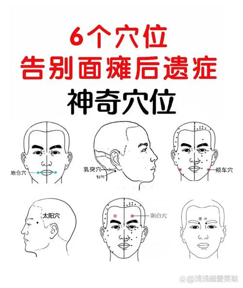 面瘫平时按摩的穴位