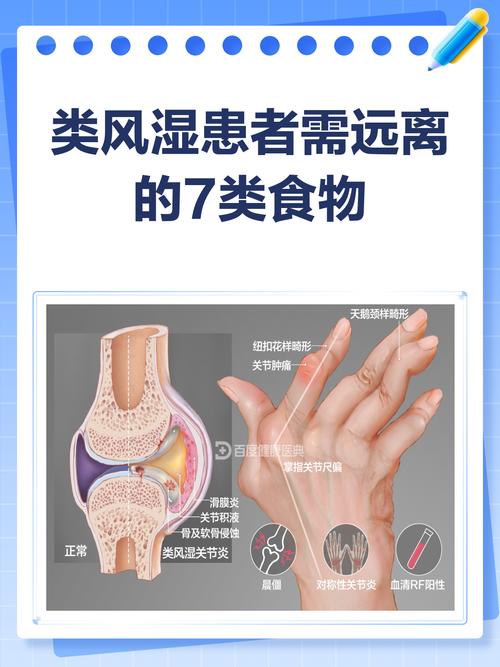 类风湿关节炎能吃东西