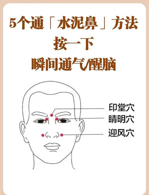 流鼻涕 穴位 拔罐