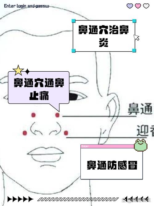流鼻涕 穴位 拔罐