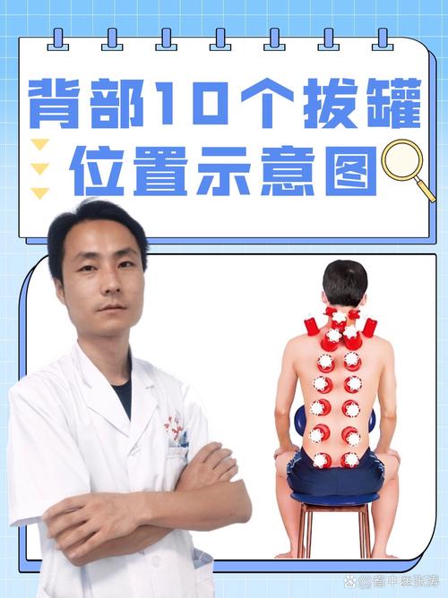 流鼻涕 穴位 拔罐