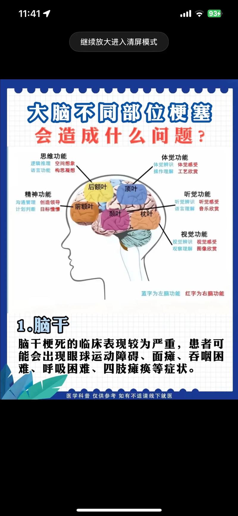 脑梗前兆和脑梗的区别