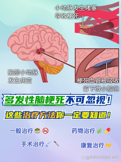 基底节脑梗为什么脑梗