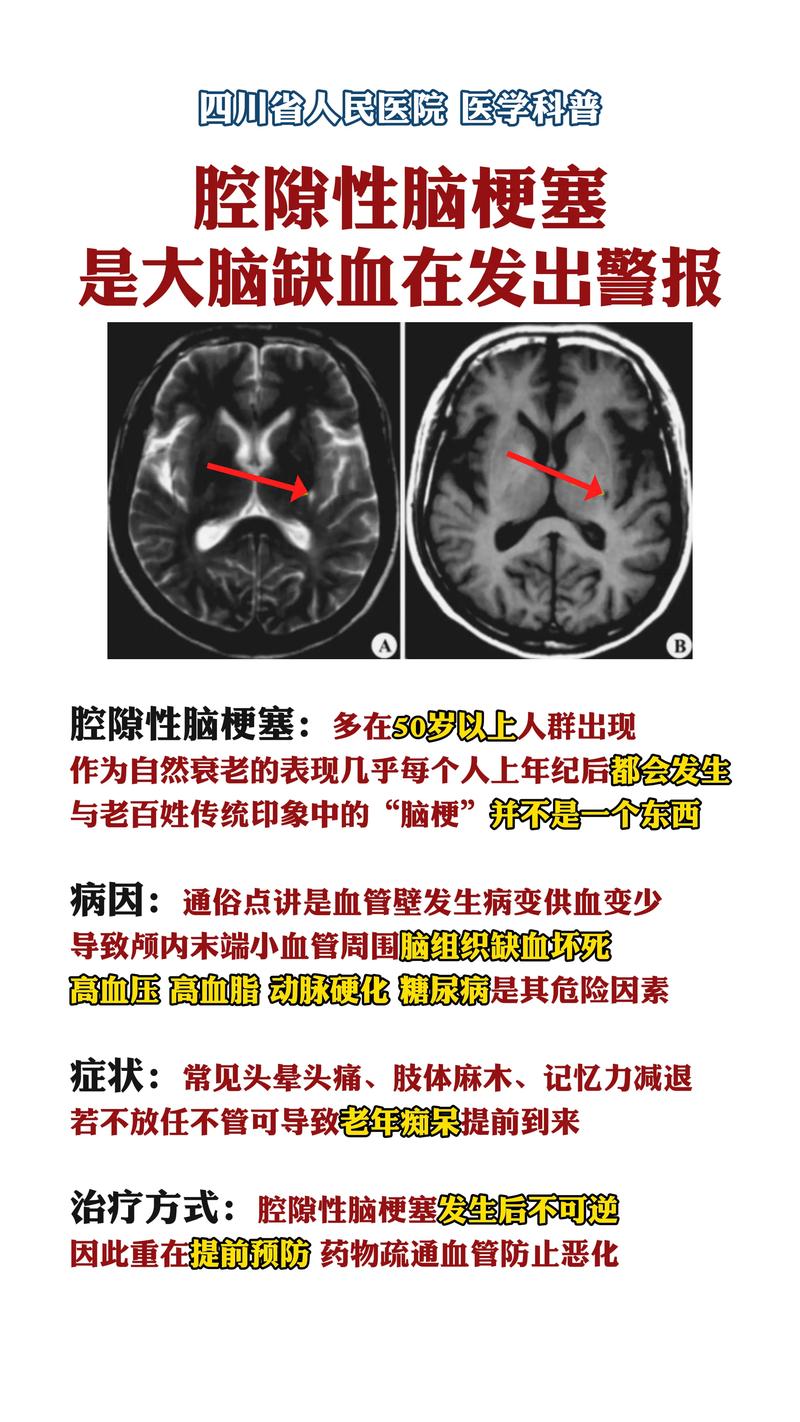 腔系脑脑腔梗成丘脑梗