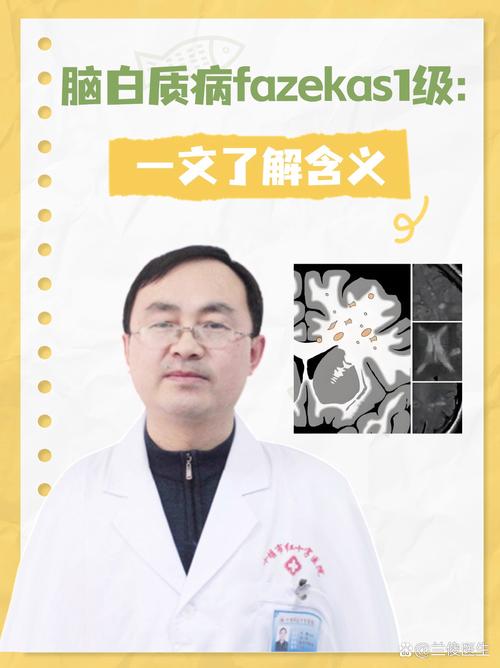 fazekas 脑梗