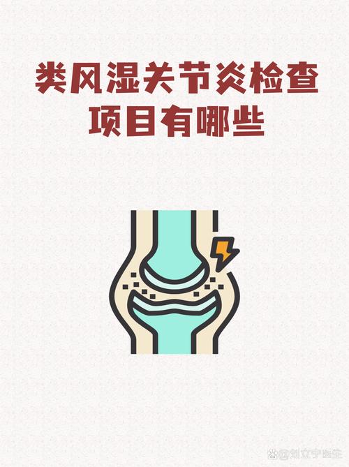 做风湿四项检查多少钱