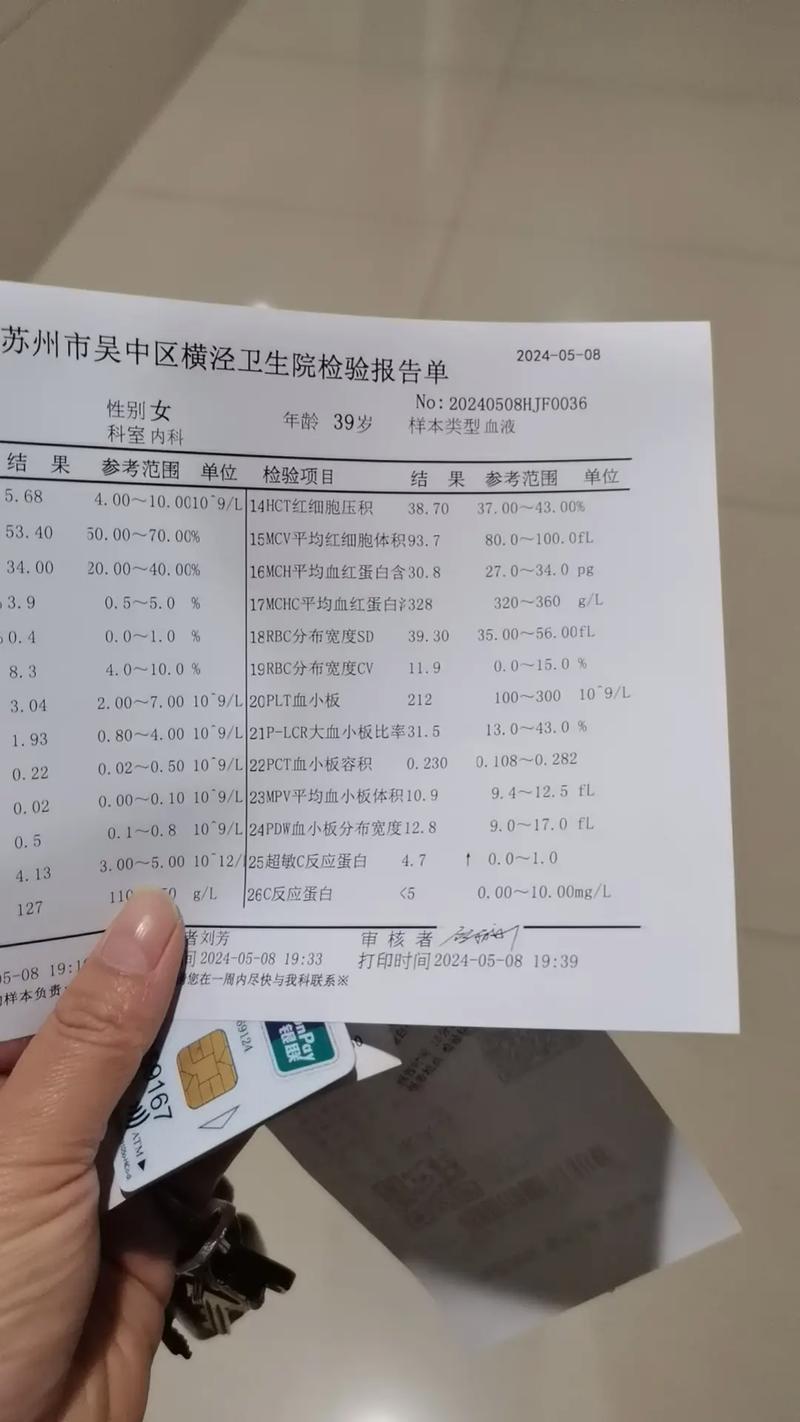 检查风湿四项要多少钱