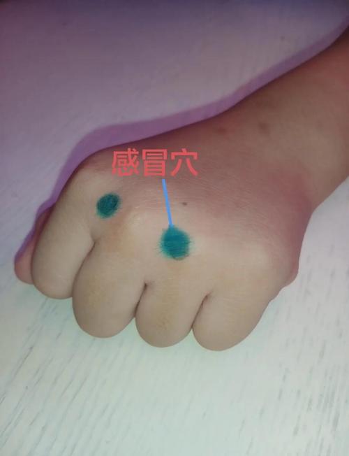 感冒发烧穴位位置图