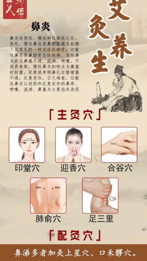 鼻炎要怎么艾灸穴位