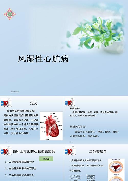 风湿性心脏病能治好么