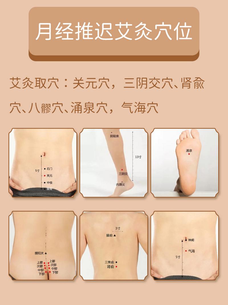 治疗闭经炙什么穴位